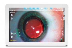 система верион